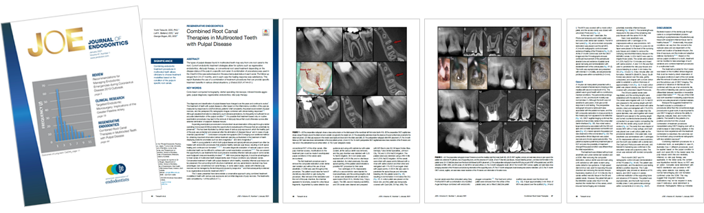 歯内療法の専門誌「JOE」