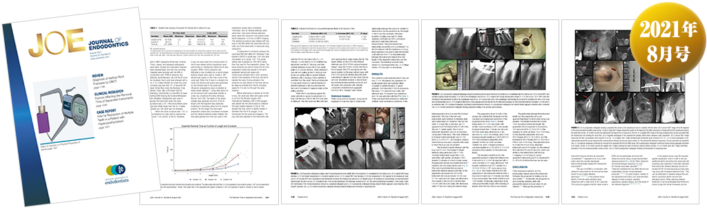 歯内療法の専門誌「JOE」